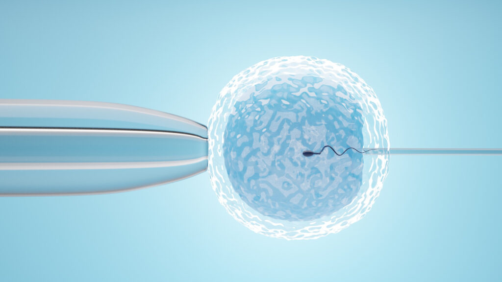 Donor Sperm Insemination